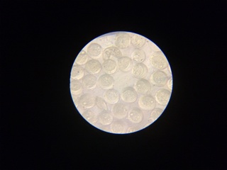 杉花粉の顕微鏡写真